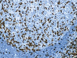 Biocare Medical, LLC CD3 T-Cell Antibody - Predilute, 6.0 ml, Quantity: