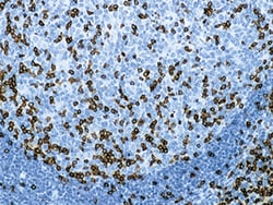 Biocare Medical, LLC CD3 T-Cell Antibody - Predilute, 25 ml, Quantity: