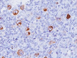 Biocare Medical, LLC Epstein-Barr Virus (EBV) Antibody - Predilute, 6.0