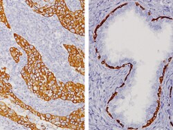 Biocare Medical, LLC Cytokeratin HMW [34Œ≤E12] Antibody - Predilute, 25