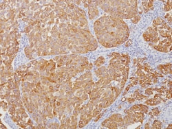 Biocare Medical, LLC&nbsp;Tyrosinase Antibody - Predilute, 6.0 ml