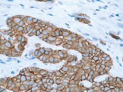 Biocare Medical, LLC E-cadherin (Mouse) Antibody - Predilute, 6.0 ml, Quantity: