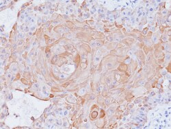 Biocare Medical, LLC Cytokeratin 17 Antibody - CK17 Antibody - Predilute,