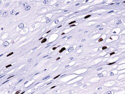 Biocare Medical, LLC HPV Cocktail Broad Spectrum Antibody - Predilute,