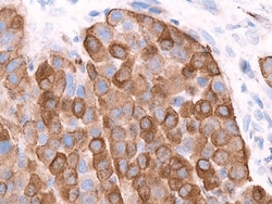Biocare Medical, LLC Pan Melanoma Cocktail-2 Antibody - Predilute, 6.0