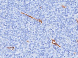 Biocare Medical, LLC D2-40 (Lymphatic Marker) Antibody - Predilute, 6.0