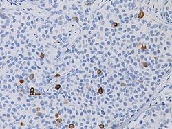 Biocare Medical, LLC Mammaglobin Antibody - Predilute, 6.0 ml, Quantity: