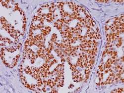 Biocare Medical, LLC Estrogen Receptor (ER) [6F11 + SP1] Antibody - Predilute,
