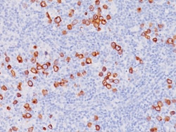 Biocare Medical, LLC CD30 (Ki-1) Antibody - Predilute, 6.0 ml, Quantity: