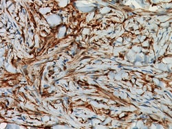 Biocare Medical, LLC Factor XIIIa Antibody - Predilute, 6.0 ml