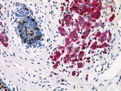 Biocare Medical, LLC&nbsp;Pan Melanoma + Ki-67 Antibody - Predilute, 6.0 ml