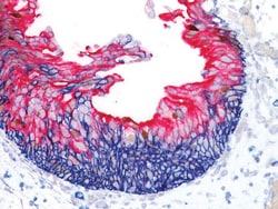 Biocare Medical, LLC URO-3 Triple Stain Antibody - Predilute, 6.0 ml, Quantity:
