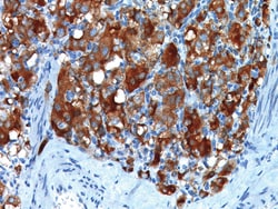 Biocare Medical, LLC Synaptophysin Antibody - Predilute, 6.0 ml, Quantity: