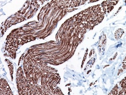 Biocare Medical, LLC Smoothelin Antibody - Predilute, 6.0 ml, Quantity: