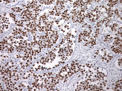 Biocare Medical, LLC SALL4 Antibody - Predilute, 6.0 ml, Quantity: Each