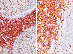 Biocare Medical, LLC CD4 + CD8 Antibody - Predilute, 6.0 ml, Quantity: