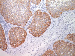 Biocare Medical, LLC Desmoglein 3 Antibody - Predilute, 6.0 ml, Quantity: