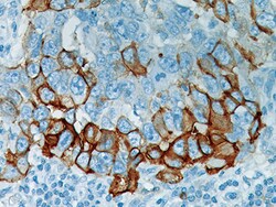 Biocare Medical, LLC PHOSPHO-EGFR Antibody - Predilute, 6.0 ml, Quantity: