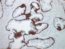 Biocare Medical, LLC Cytokeratin 5 (CK5) Antibody - Predilute, 6.0 ml,