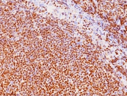 Biocare Medical, LLC Cyclin D1 Antibody - Predilute, 6.0 ml, Quantity: