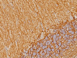 Biocare Medical, LLC Glial Fibrillary Acidic Protein Antibody - Predilute,