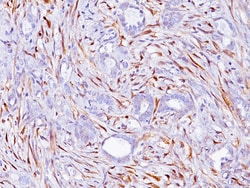 Biocare Medical, LLC Calretinin Antibody - Predilute, 6.0 ml, Quantity: