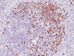 Biocare Medical, LLC Terminal Deoxynucleotidyl Transferase Antibody - Predilute,