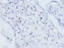 Biocare Medical, LLC Treponema Pallidum Antibody - Predilute, 6.0 ml, Quantity: