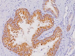 Biocare Medical, LLC P504S Antibody - Predilute, 25 ml, Quantity: Each