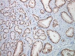 Biocare Medical, LLC NKX3.1, Human Protein, 1.6 ml, Stains Nuclei in Both