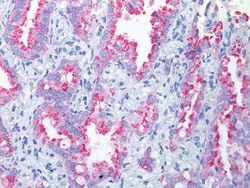 Biocare Medical, LLC Napsin A Antibody - Predilute, 6.0 ml, Quantity: Each