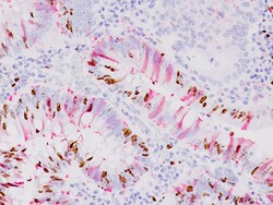 Biocare Medical, LLC&nbsp;Ki-67 + Caspase-3 Antibody - Predilute, 6.0 ml