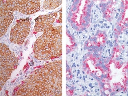 Biocare Medical, LLC Desmoglein 3 + Napsin A Antibody - Predilute, 6.0