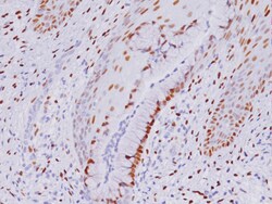 Biocare Medical, LLC Estrogen Receptor (ER) [SP1] Antibody - Predilute,