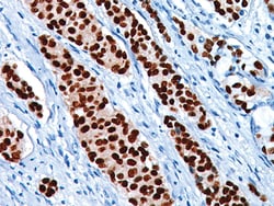 Biocare Medical, LLC Progesterone Receptor (PR) [SP2] Antibody - Predilute,
