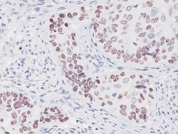 Biocare Medical, LLC p40 (P) Antibody, Recognizes the Shortest Variant