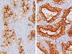 Biocare Medical, LLC Folate Receptor alpha IHC Assay Kit Antibody - Predilute,