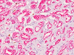 Biocare Medical, LLC AMACR (RM) Antibody - Predilute, 6.0 ml, Quantity:
