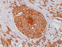 Biocare Medical, LLC&nbsp;Human-on-Human HRP-Polymer Kit, Enables Rapid Screening of Multiple Human Primary Antibody Clones