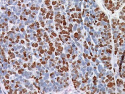 Biocare Medical, LLC Ki-67 (R) Antibody - Predilute, 25 ml, Quantity: Each