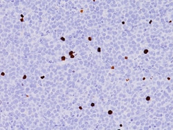 Biocare Medical, LLC Phosphohistone H3 (pHH3) (RM) Antibody, 6.0 ml, Quantity: