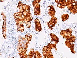 Biocare Medical, LLC Mesothelin Antibody - Concentrate, 0.5 ml, Quantity: