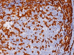 Biocare Medical, LLC CD3 [LN10] Antibody - Concentrate, 1.0 ml, Quantity: