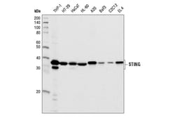 Cell Signaling Technology STING (D2P2F) Rabbit mAb 100 µl, Quantity: Each