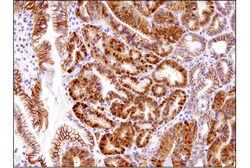 Cell Signaling Technology Non-phospho (Active) beta-Catenin (Ser45) (D2U8Y)