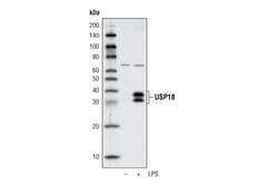 Cell Signaling Technology USP18 (D4E7) Rabbit mAb 100 µl, Quantity: Each
