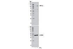 Cell Signaling Technology HIF-2alpha (D9E3) Rabbit mAb 100 µl, Quantity: