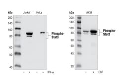 Cell Signaling Technology Phospho-Stat3 (Tyr705) (D3A7) XP Rabbit mAb 100