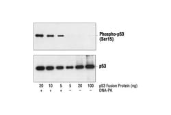 Cell Signaling Technology Phospho-p53 (Ser15) Antibody 100 µl, Quantity: