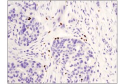 Cell Signaling Technology FoxP3 (D2W8E) Rabbit mAb (IHC Specific) 100 µl,